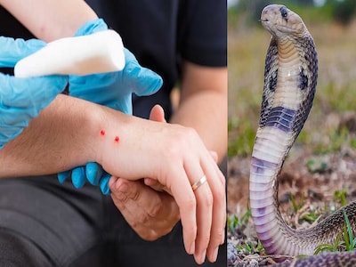 सर्पदंश की स्थिति में करें यह कार्य