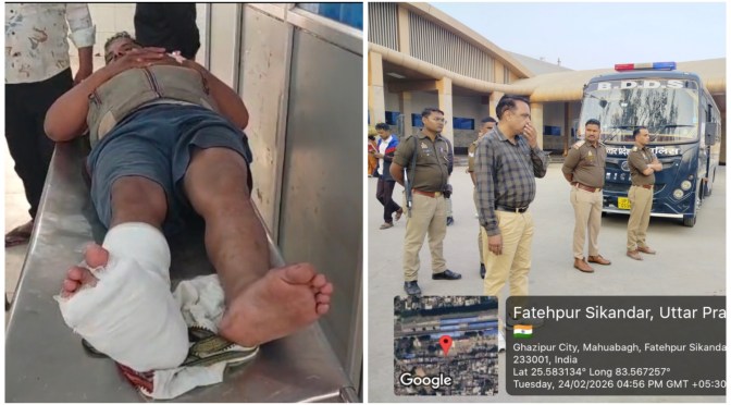 ई रिक्शा चालक के पैर के नीचे फटा बम, हुआ घायल